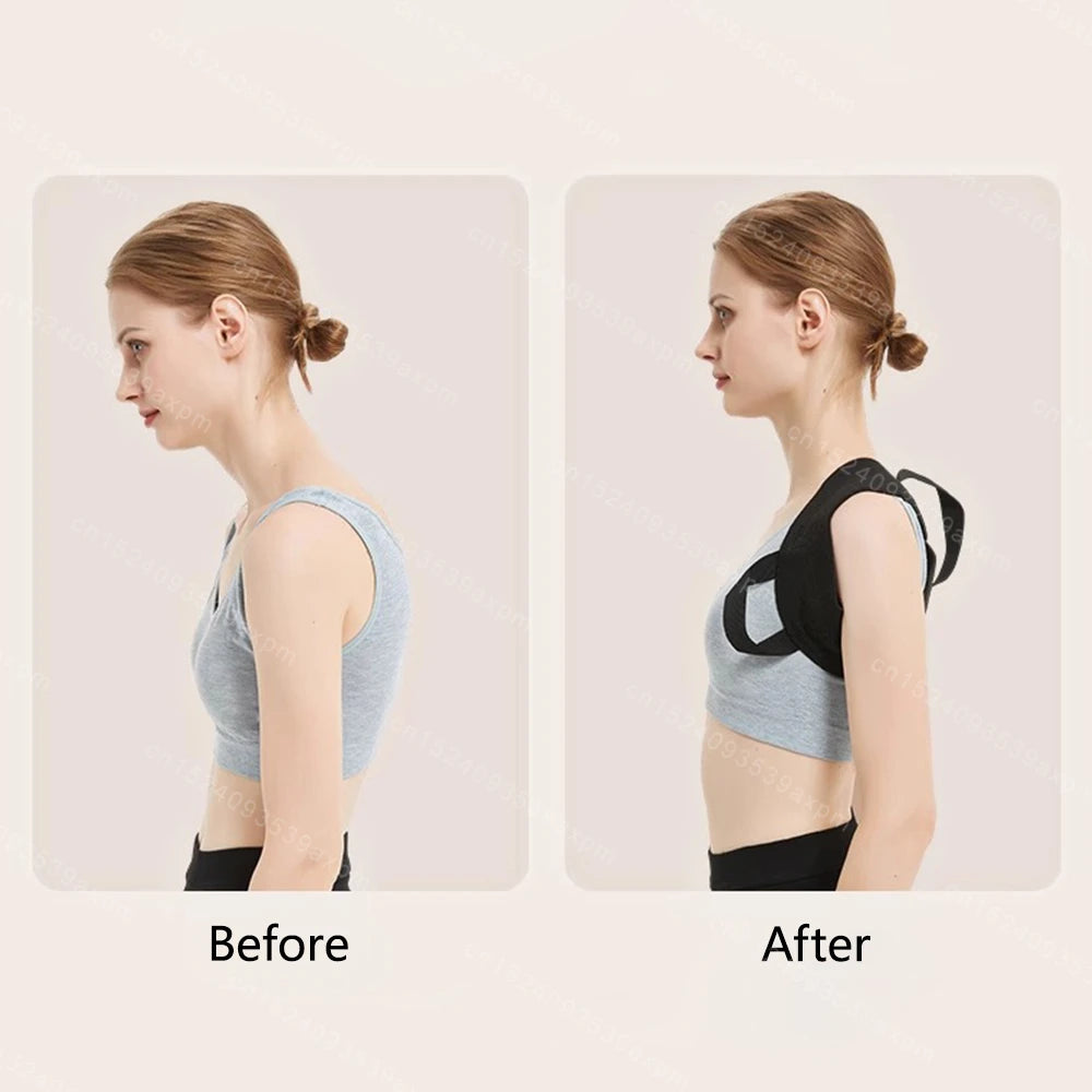 - Unisex Spine Alignment Belt – Shoulder & Upper Back Brace